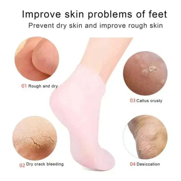 ✨ (BUY 1 GET 1 FREE)Moisturizing Gel Heel Silicone Socks (4 PCS) 🦶
