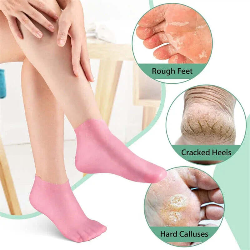 ✨ (BUY 1 GET 1 FREE)Moisturizing Gel Heel Silicone Socks (4 PCS) 🦶